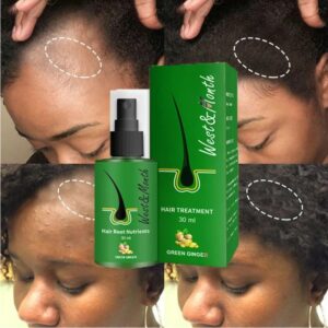 Onion Black Seed Hair Oil Spray for Natural Hair Care and Growth Prevent  Hair Loss Biotin Fast Hair Growth - Hair Candy Beauty