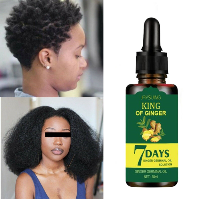 Hair Growth Oil Hair Loss Thinning Haircare Serum Baldness Fast Thick Long  Organic Hair Products for Black Women 30ML - Hair Candy Beauty