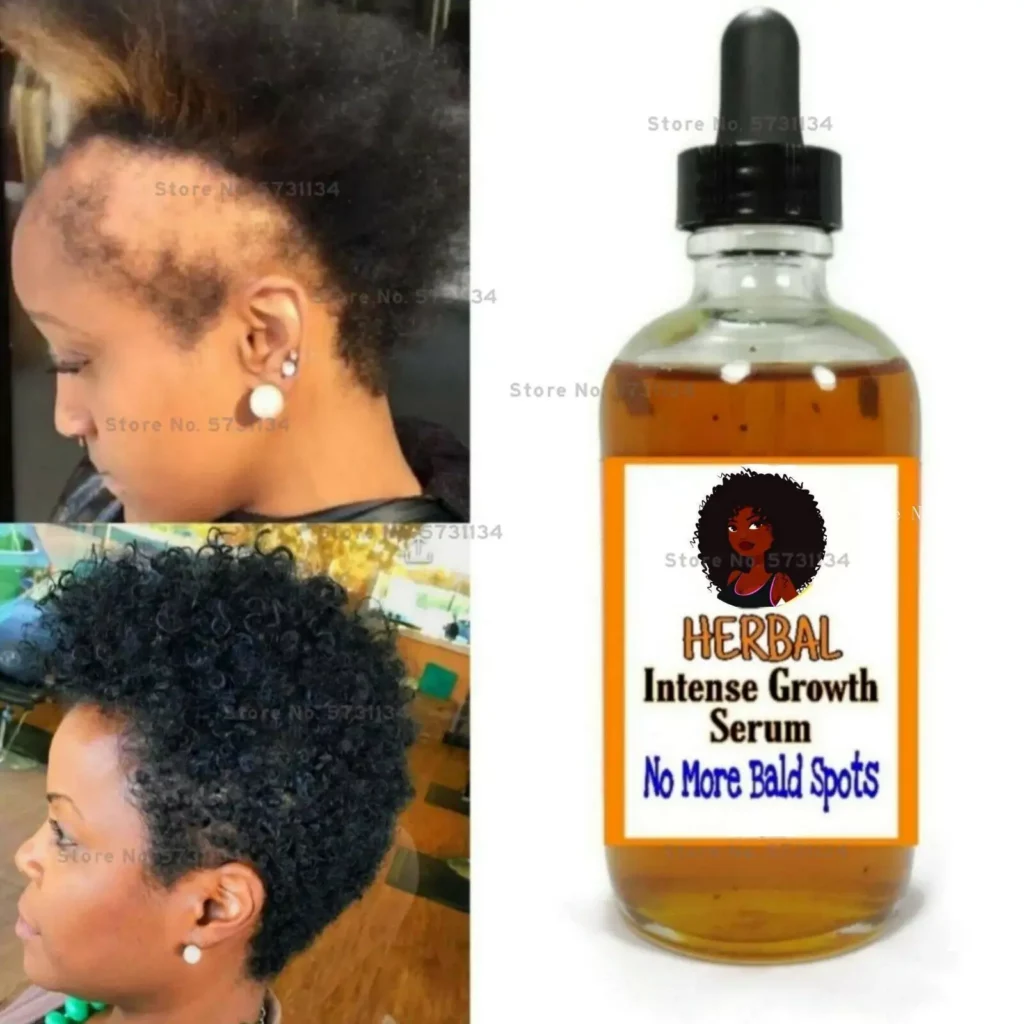 Black Seed Castor Oil Hair Growth Serum, Thick Hair, Fast Growth 20ml